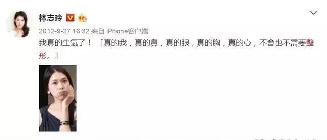 邓紫棋杨颖杨幂杨紫张天爱熊黛林by2林志玲娄艺潇辟谣方式分析_娱乐圈明星整容自证未整容方法_娱乐圈没整过容的明星